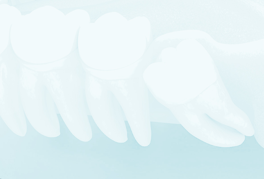 Pathologies dentaires et dents de sagesse - Dr Blandine RUHIN